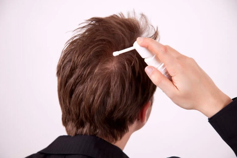 Συναγερμός από τον ΕΟΦ για σπρέι για την τριχόπτωση – Επικίνδυνο για την υγεία – Μην το χρησιμοποιήσετε!